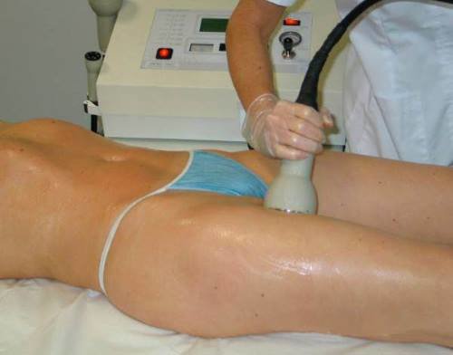 Tratamiento corporal con Meso-Vac