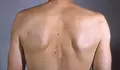 Piel seca 01