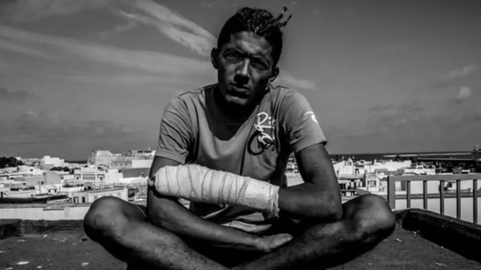 A Samir, argelino de 21, le negaron la atenci&oacute;n sanitaria en el hospital por no tener papeles tras sufrir una agresi&oacute;n policial | FOTO: M&eacute;dicos del Mundo