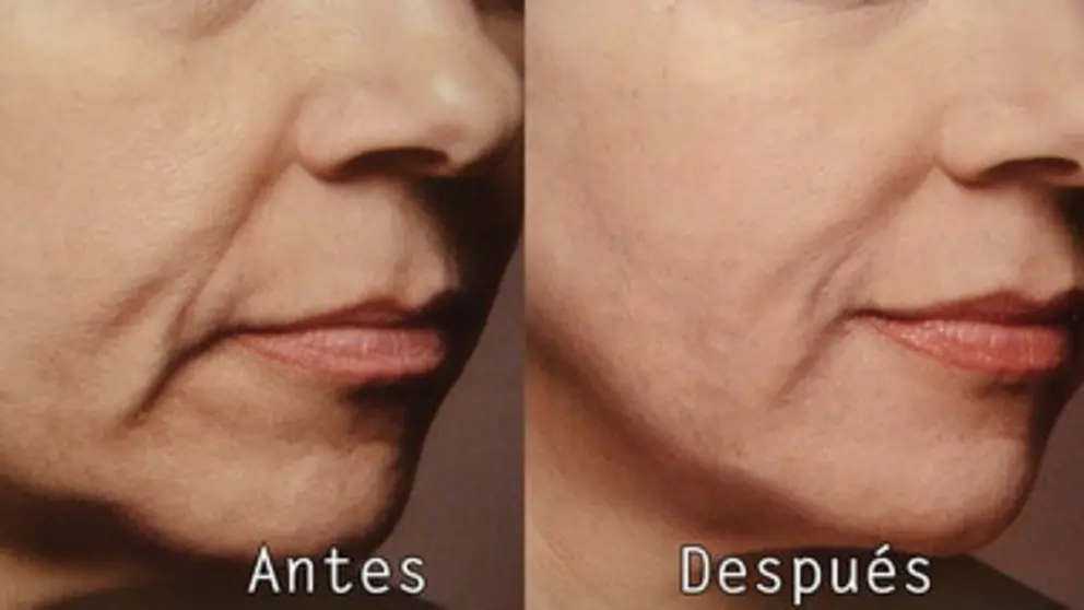 ImplantesFaciales02_redimensionar